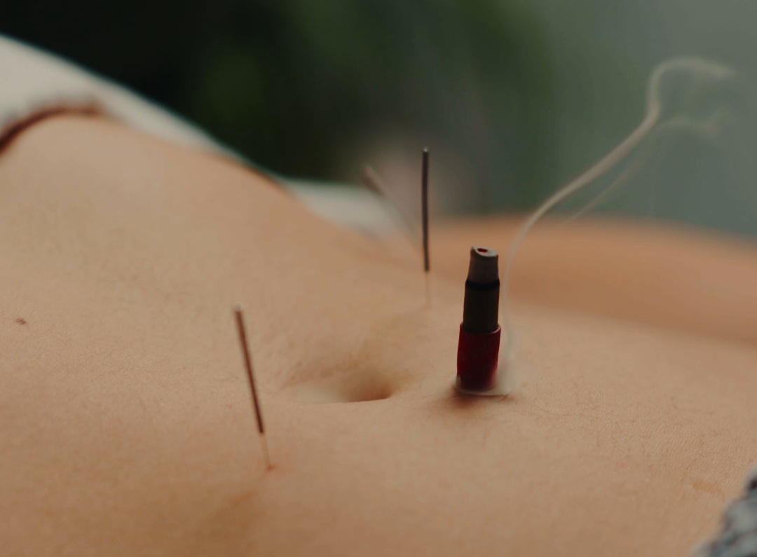 Integrated Elements Acupuncture + Health